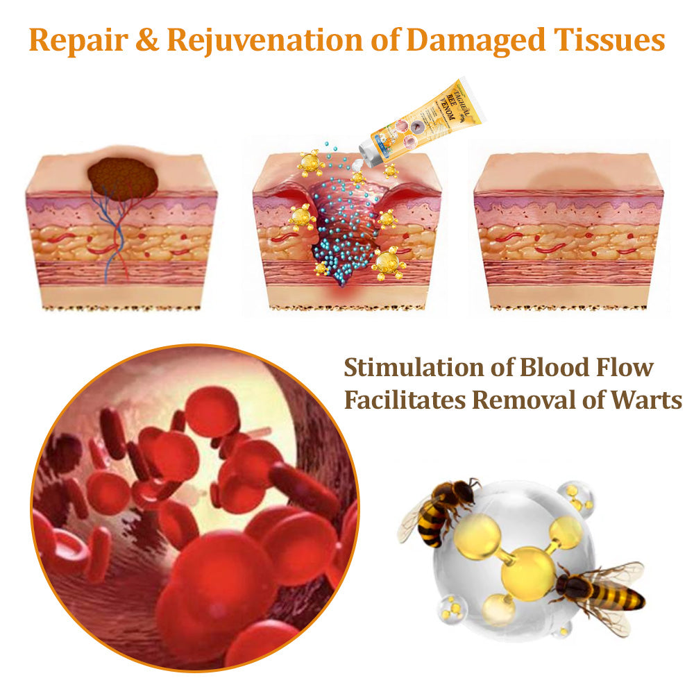 flysmus™Tagheal Bee Venom Mole and Wart Treatment Cream🐝( Dermatologist Recommended👩‍⚕️✅）