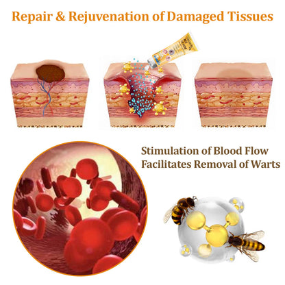 flysmus™Tagheal Bee Venom Mole and Wart Treatment Cream🐝( Dermatologist Recommended👩‍⚕️✅）