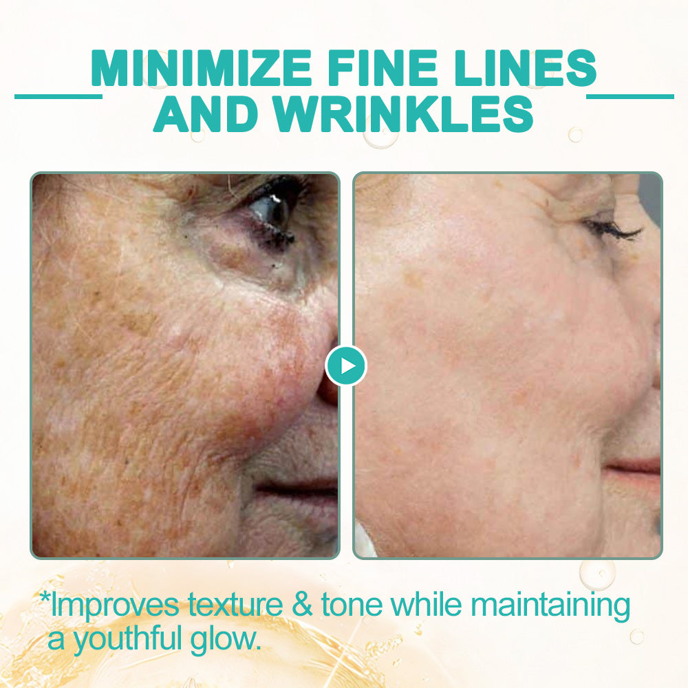 🌻flysmus™ Luxilift Collagen-Powered Firming Body Massage Oil (Targets Stretch Marks & Cellulite)