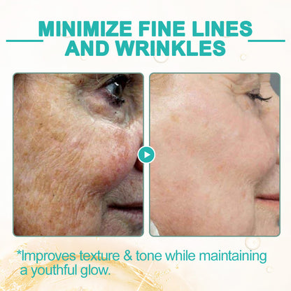 🌻flysmus™ Luxilift Collagen-Powered Firming Body Massage Oil (Targets Stretch Marks & Cellulite)