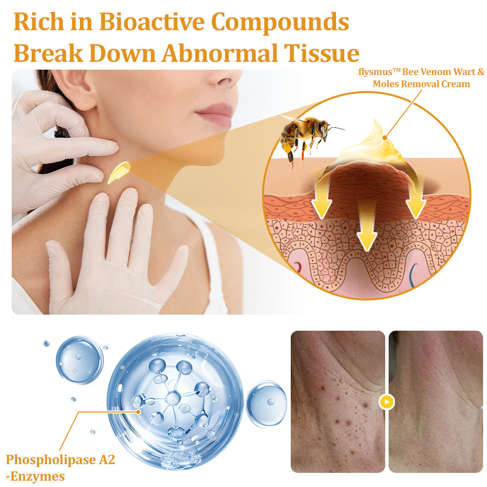 flysmus™ TagCure Bee Venom Skincare Cream🐝(Removes Warts & Moles)