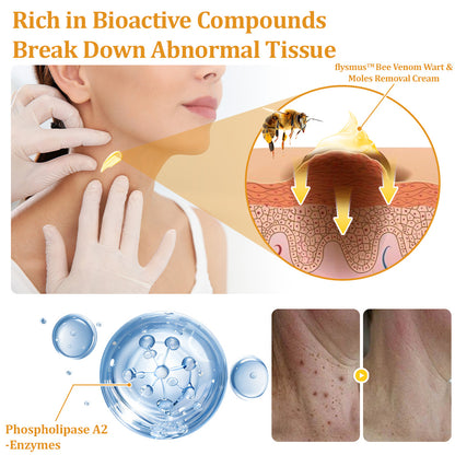 flysmus™ TagCure Bee Venom Skincare Cream🐝(Removes Warts & Moles)