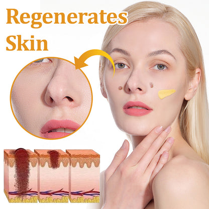 flysmus™ TagCure Bee Venom Skincare Cream🐝(Removes Warts & Moles)