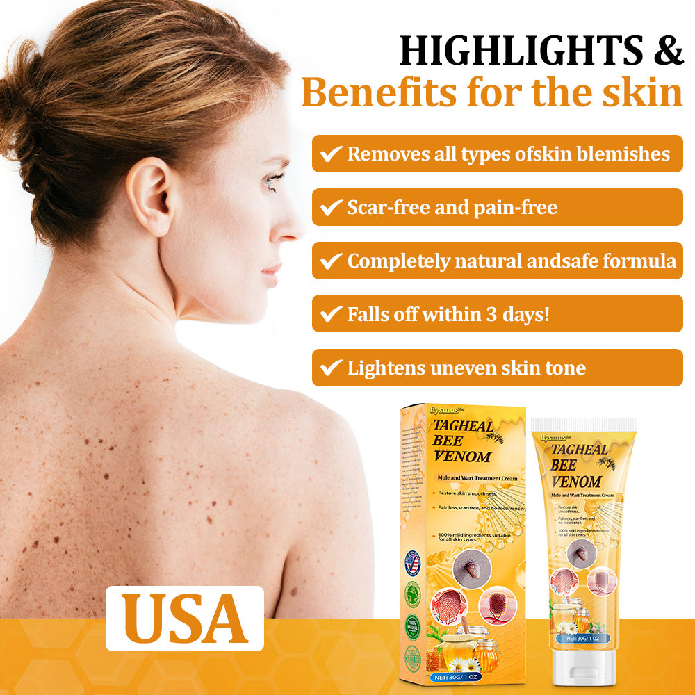 flysmus™Tagheal Bee Venom Mole and Wart Treatment Cream🐝( Dermatologist Recommended👩‍⚕️✅）