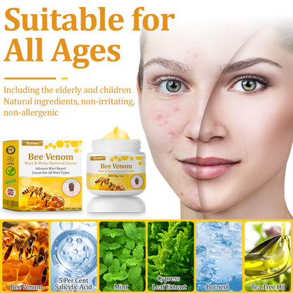 flysmus™ TagCure Bee Venom Skincare Cream🐝(Removes Warts & Moles)