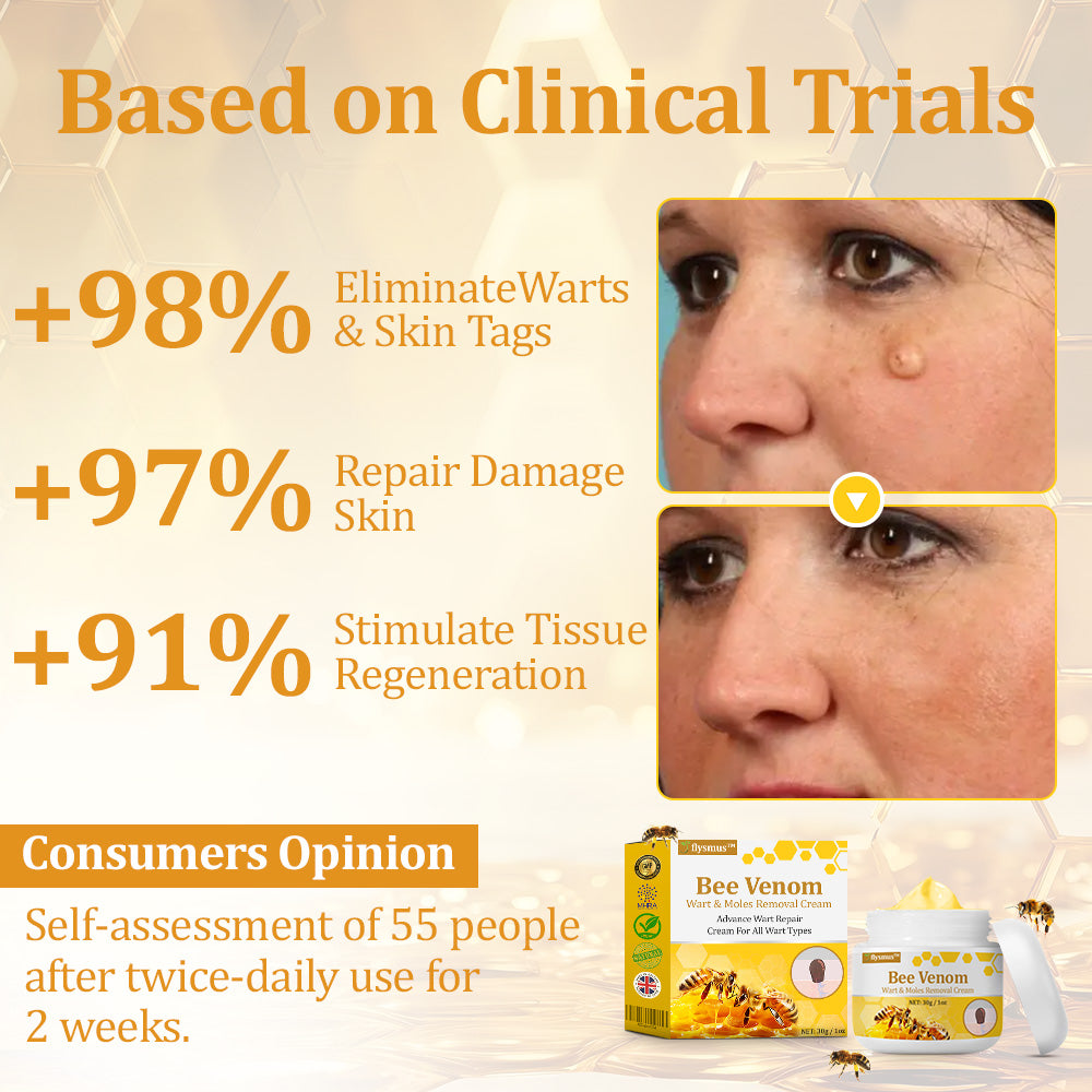 flysmus™ TagCure Bee Venom Skincare Cream🐝(Removes Warts & Moles)
