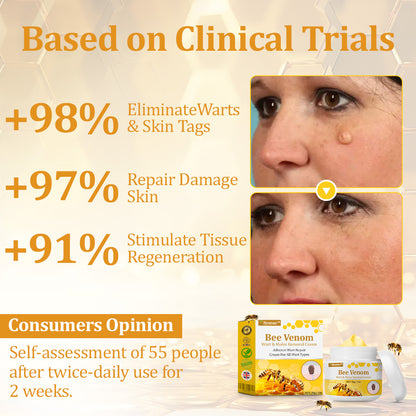 flysmus™ TagCure Bee Venom Skincare Cream🐝(Removes Warts & Moles)