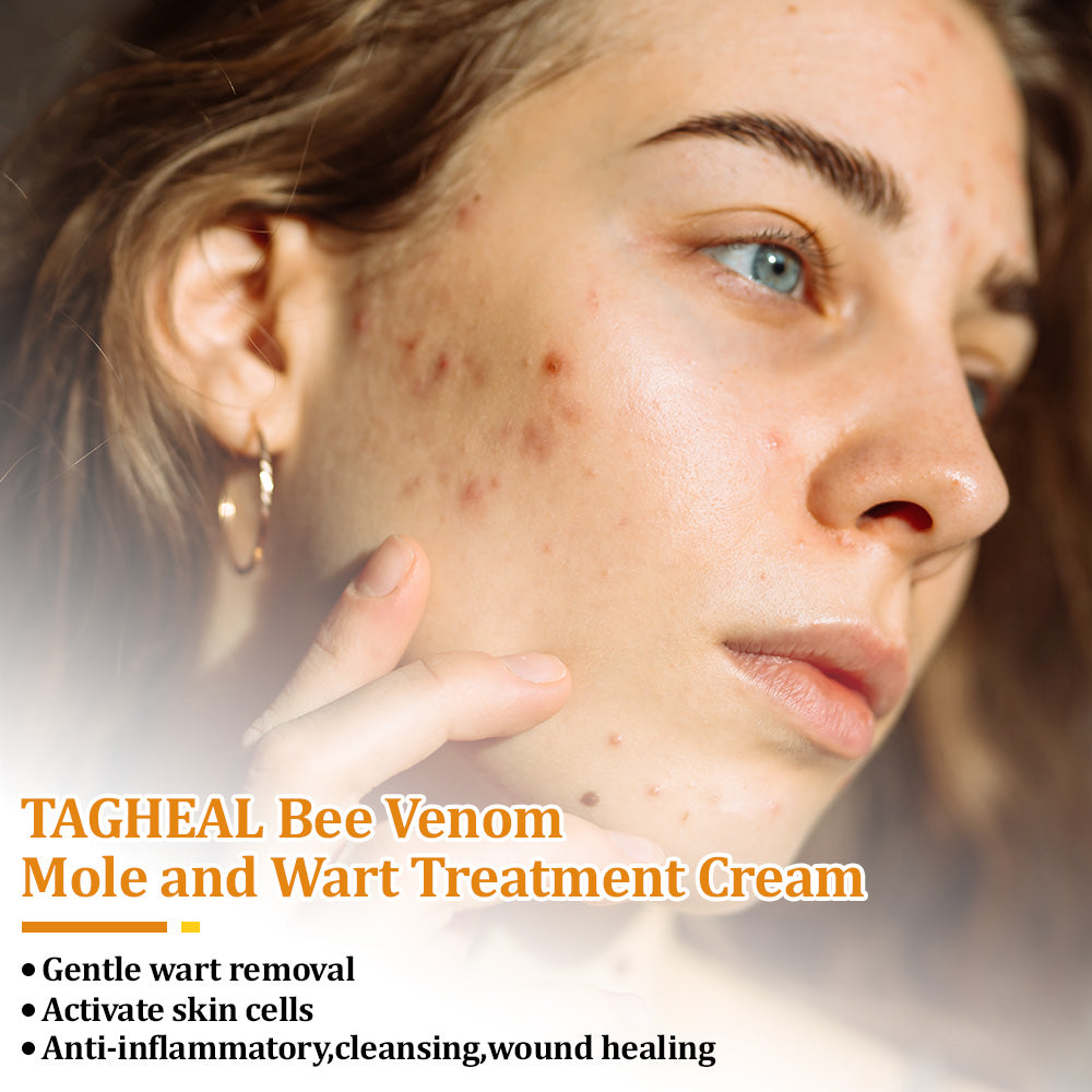 flysmus™Tagheal Bee Venom Mole and Wart Treatment Cream🐝( Dermatologist Recommended👩‍⚕️✅）