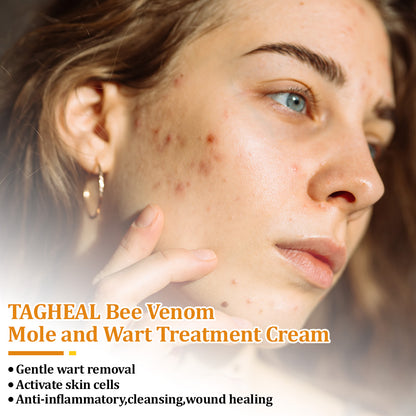 flysmus™Tagheal Bee Venom Mole and Wart Treatment Cream🐝( Dermatologist Recommended👩‍⚕️✅）