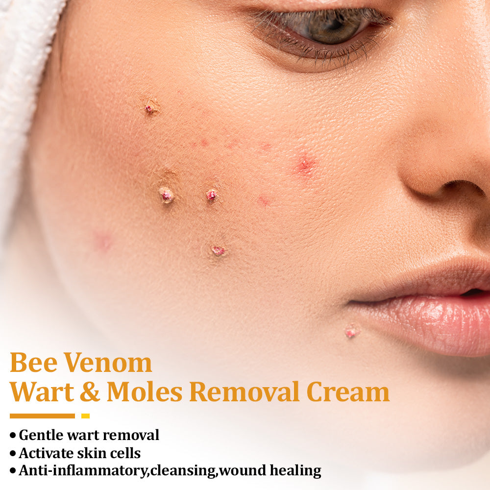 flysmus™ TagCure Bee Venom Skincare Cream🐝(Removes Warts & Moles)