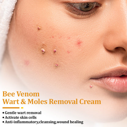 flysmus™ TagCure Bee Venom Skincare Cream🐝(Removes Warts & Moles)