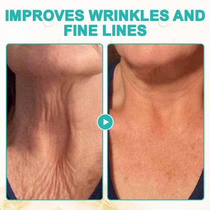 🌻flysmus™ Luxilift Collagen-Powered Firming Body Massage Oil (Targets Stretch Marks & Cellulite)
