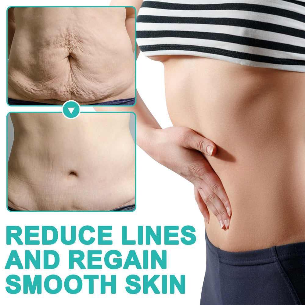 🌻flysmus™ Luxilift Collagen-Powered Firming Body Massage Oil (Targets Stretch Marks & Cellulite)
