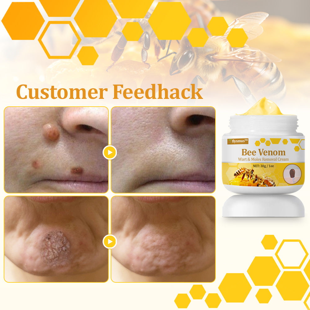 flysmus™ TagCure Bee Venom Skincare Cream🐝(Removes Warts & Moles)