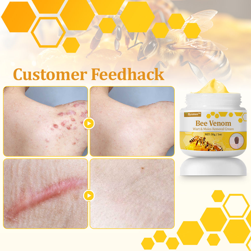 flysmus™ TagCure Bee Venom Skincare Cream🐝(Removes Warts & Moles)